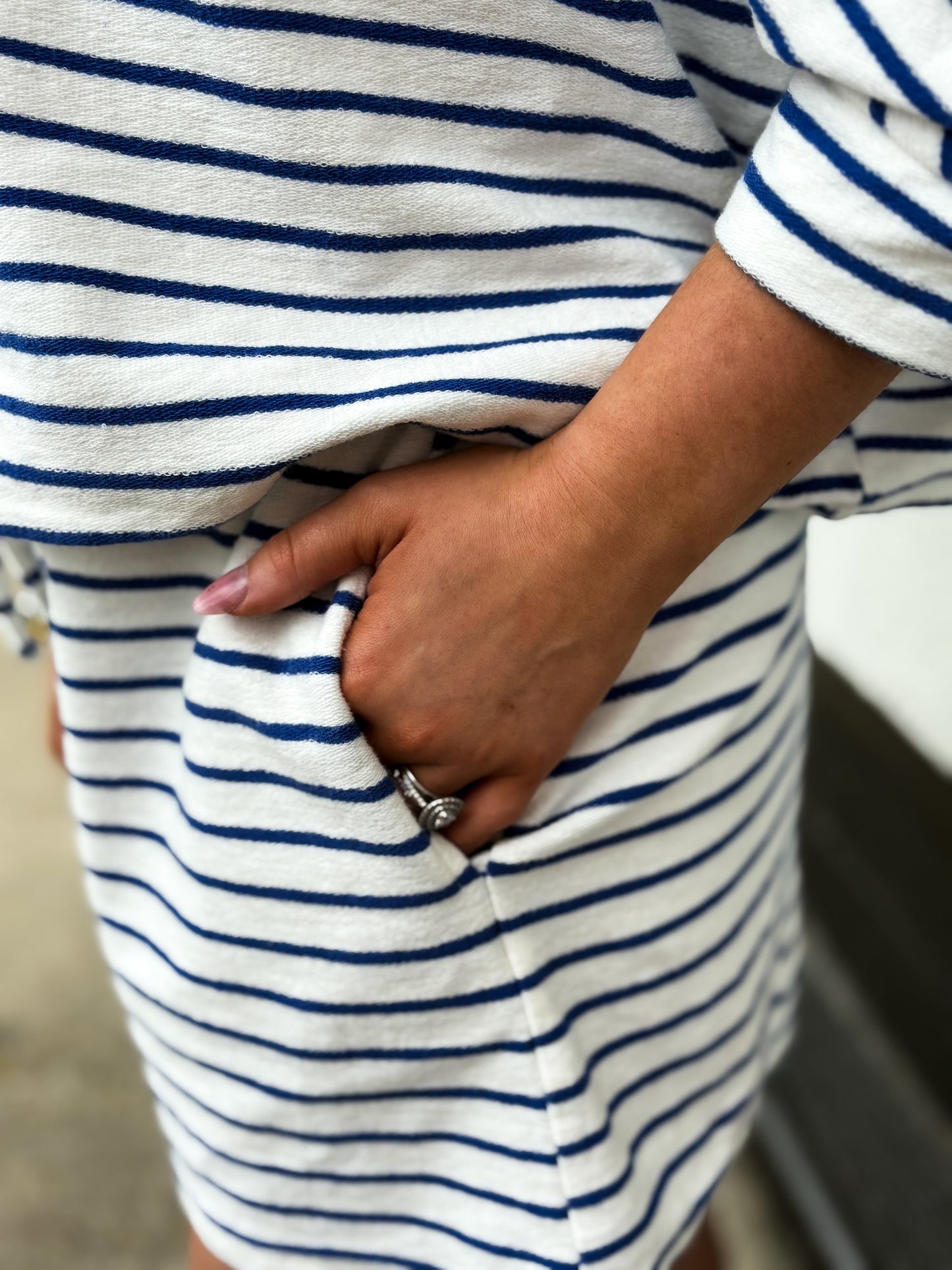 Elevated Ease Stripe Set